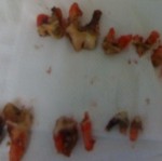 nine tartar and calculus encrusted teeth extracted from a suffering german shepherd dog's mouth lined up on a gauze pad